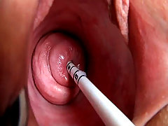 Real Cervix Fucking Insertion