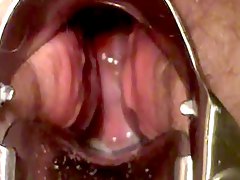  bbw masturbate with speculum show cervix 