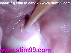 Insertion Semen Cum in Cervix Wide Stretching 
